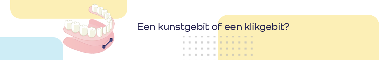 Blog_banner_1250x200px_kunstgebit of klikgebit