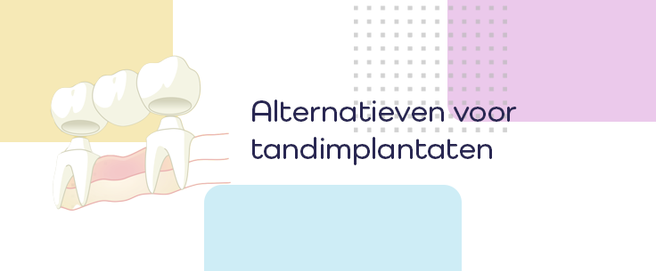 Blog_banner_734x305px_mobille_alternatieven
