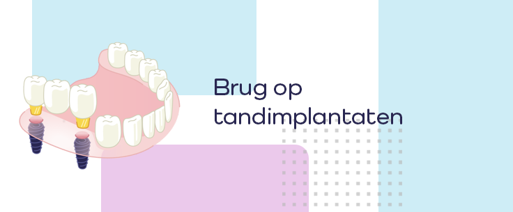 brug