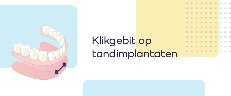Blog_banner_734x305px_mobille_klikgebit